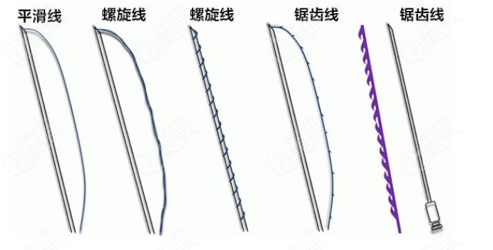 合肥可以做微创面部提升的医院