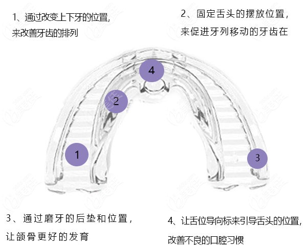 樂(lè)盛美牙齒矯正器怎么樣