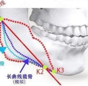 從沈陽(yáng)下頜角整形價(jià)格表來(lái)看在沈陽(yáng)做下頜角截骨多少錢