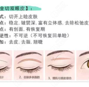運(yùn)城麗都做雙眼皮的手術(shù)費(fèi)用