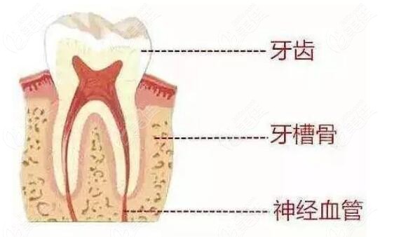 戴了活动牙后还可以做种植牙吗