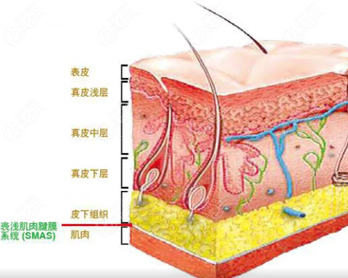 王志軍高位smas除皺術(shù)挺不錯(cuò)的