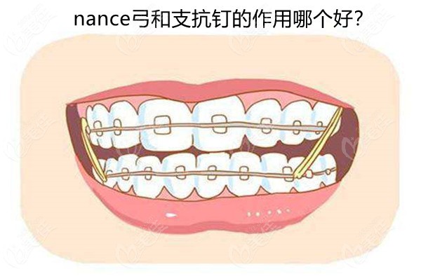 nance弓和支抗釘?shù)淖饔媚膫€(gè)好