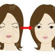 遼寧沈陽正規(guī)醫(yī)院做拉皮除皺手術(shù)價(jià)格一覽表