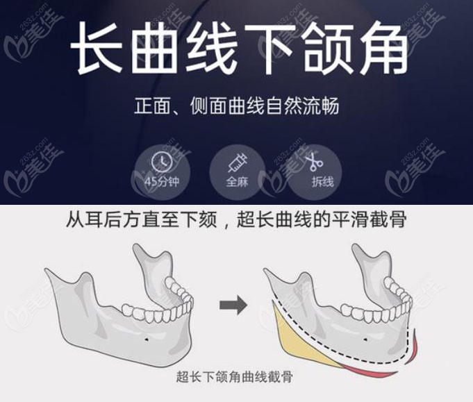 合肥华美医院能做磨颧骨手术吗