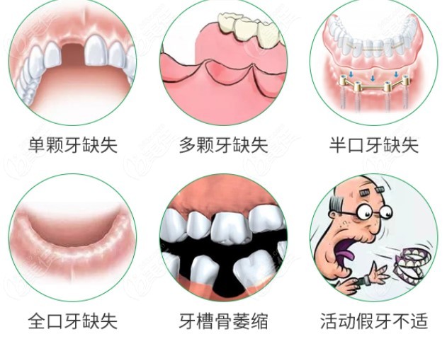 上海金山区种植牙医院排名及金山区种植牙品牌及价格公布