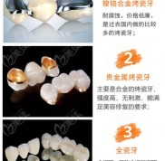 嘮嘮長(zhǎng)春鑲牙多少錢一顆吧
