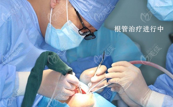 终于拿到了杭州口腔医院根管治疗的费用表