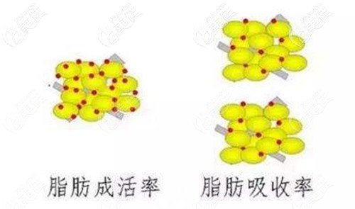 脂肪填充O型腿后经常走路会影响脂肪成活率吗