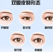 太原尚大夫媚顏做雙眼皮價格已出