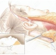 武漢做拉皮手術(shù)排名前十的醫(yī)院