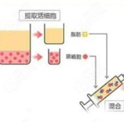 有人在南寧悅美韓星做過脂肪填充嘛