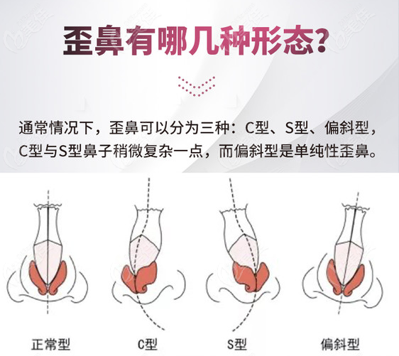 王旭明做鼻子國內(nèi)前五