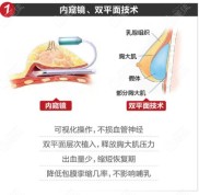 昆明藝星整形做假體隆胸怎么樣