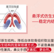 武漢做鼻子有名氣的醫(yī)生整鼻子技術(shù)就是靠譜