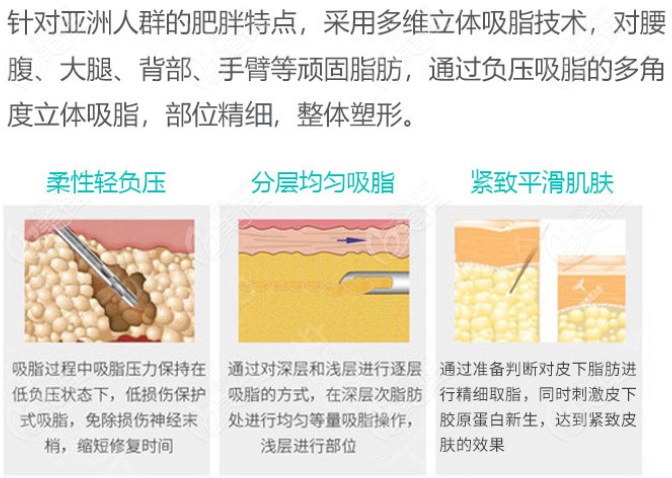 韓國吸脂和中國吸脂區(qū)別明顯