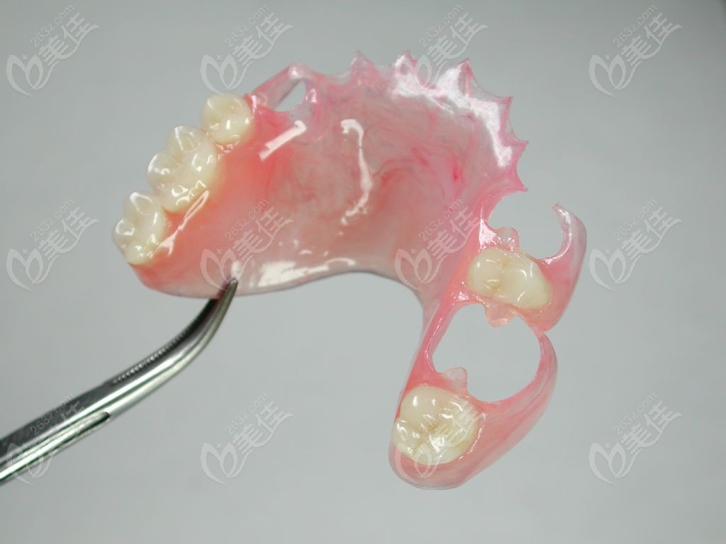 活动假牙隐形义齿图片素材-编号32241775-图行天下