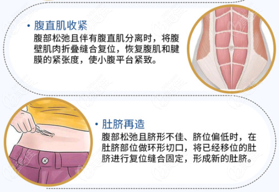 國內(nèi)肚臍眼整形術(shù)哪些醫(yī)院能做