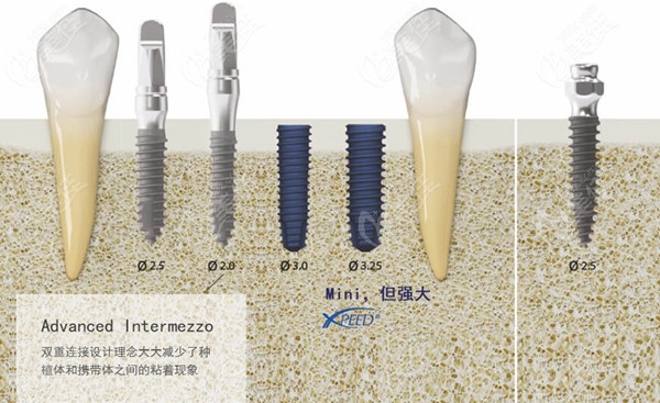 美格真植體分為哪幾種型號(hào)