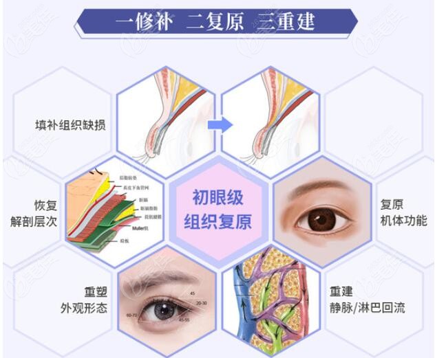 这份北京双眼皮修复比较好的医生排行名单中前三位修复双眼皮价格便宜点
