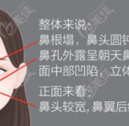 上饒做隆鼻手術價格多少錢