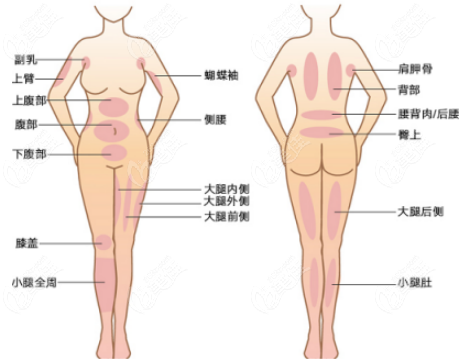 常德做威塑吸脂哪家医院好