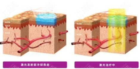 2022年医美抗衰新宠