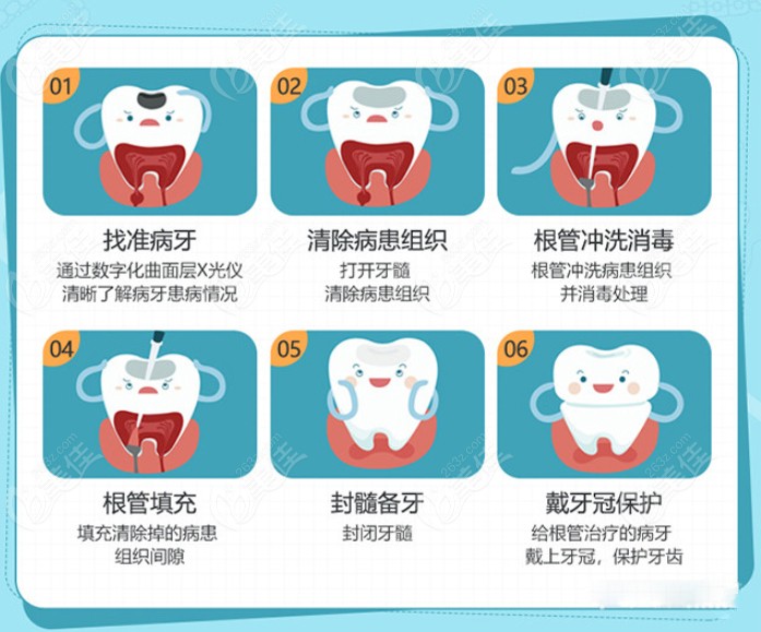 南京根管治療費(fèi)用不出意外的來了