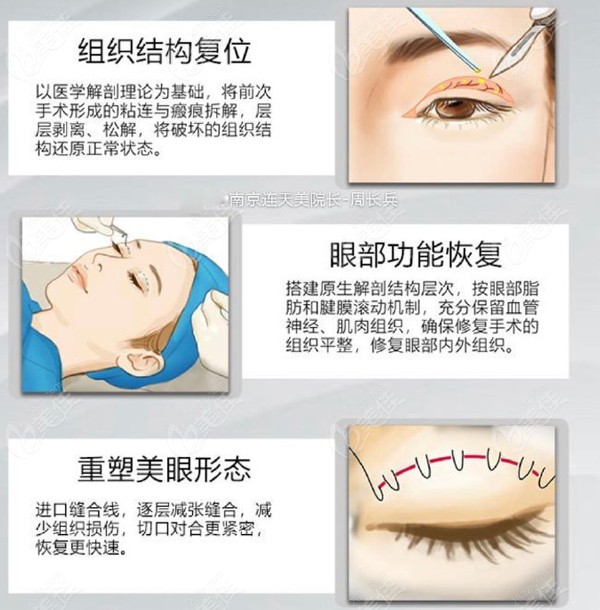 30余年眼部修復經驗在手