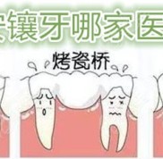 在西安鑲假牙選哪個(gè)醫(yī)院好