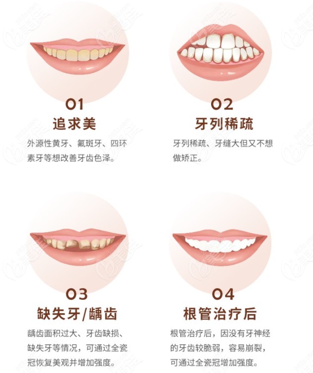 看了苏州全瓷牙价格表