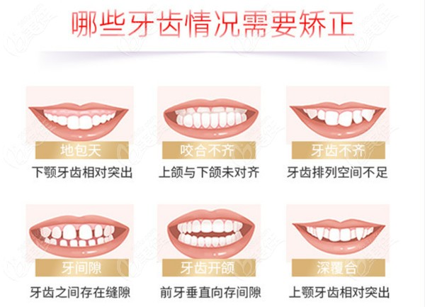 北京顺义博爱口腔价格表含有种植牙、牙齿矫正、拔牙等收费标准