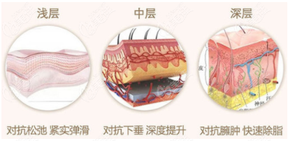 福州热拉提哪里做得好呀