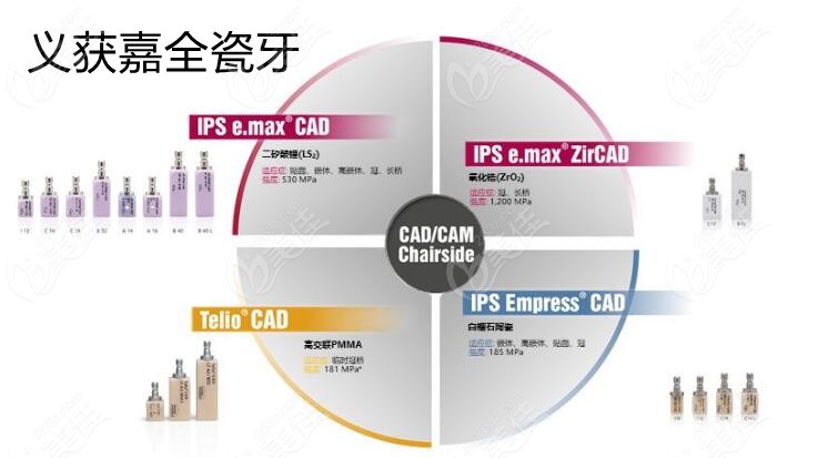 emax鑄瓷嵌體的價格是多少