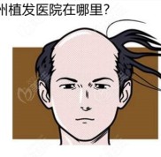 揚州植發(fā)醫(yī)院在哪里