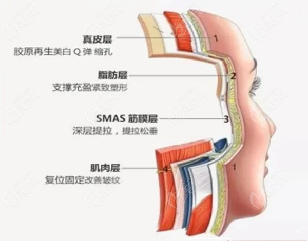 田永成整形做TBM面部提升用的是西班牙進(jìn)口線材除皺