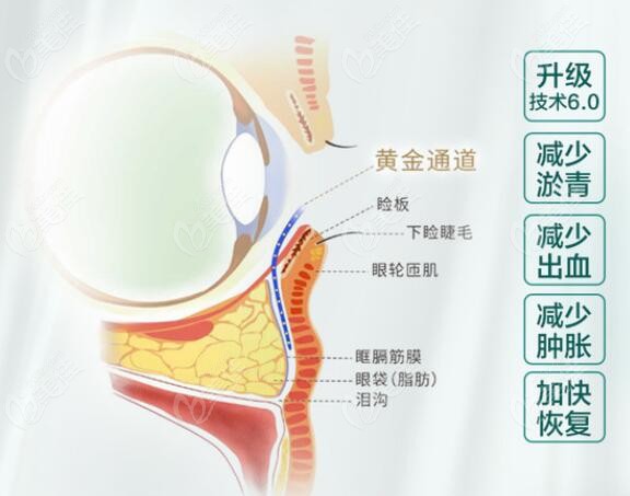南京去眼袋好的整形医院给出南京割眼袋的价格