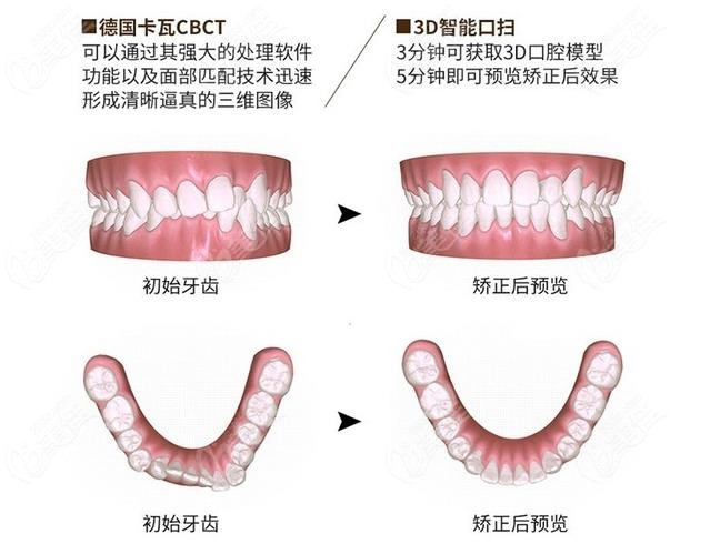 鄭州德韓口腔整牙怎么樣