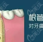 烏魯木齊哪家口腔醫(yī)院根管治療收費低