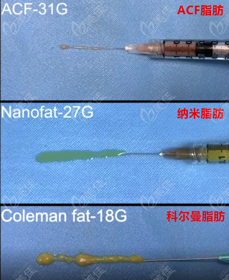 新型皮膚填充劑