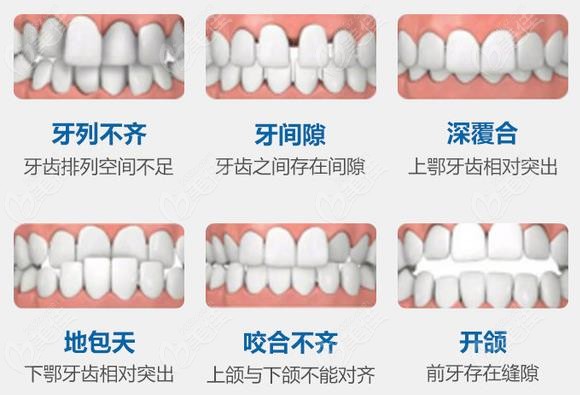 这有郑州二七区牙齿矫正的价格表