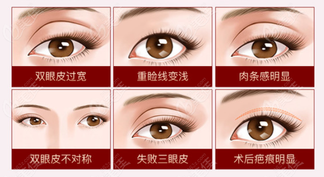 北京做双眼皮修复好的医生排名有变动