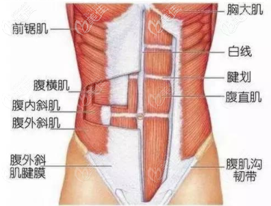 馬甲線手術(shù)如何雕塑