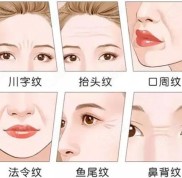 南寧拉皮除皺去哪家醫(yī)院比較好