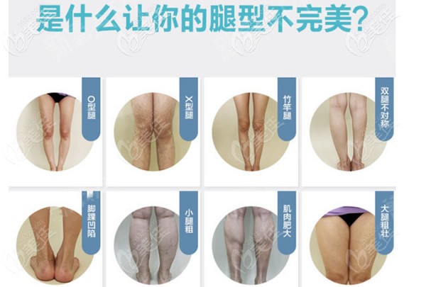 直腿成型術(shù)和抽脂減大腿有啥區(qū)別