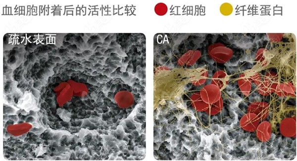 韩国奥齿泰钙离子亲水种植体TSIII CA系统