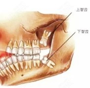 昆明拔智齒多少錢一顆