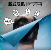歸納總結(jié)包頭市植發(fā)醫(yī)院哪家好
