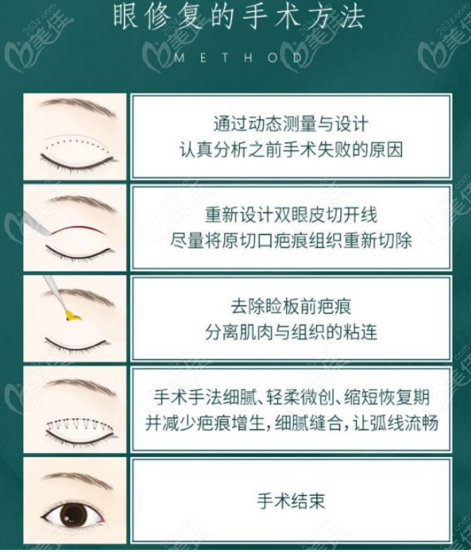 上海爱尚丽格杜园园修复双眼皮怎么收费