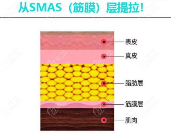 ?上海小切口拉皮哪家医院好